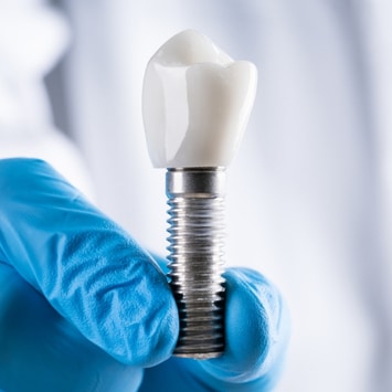 implant-dis-tedavileri